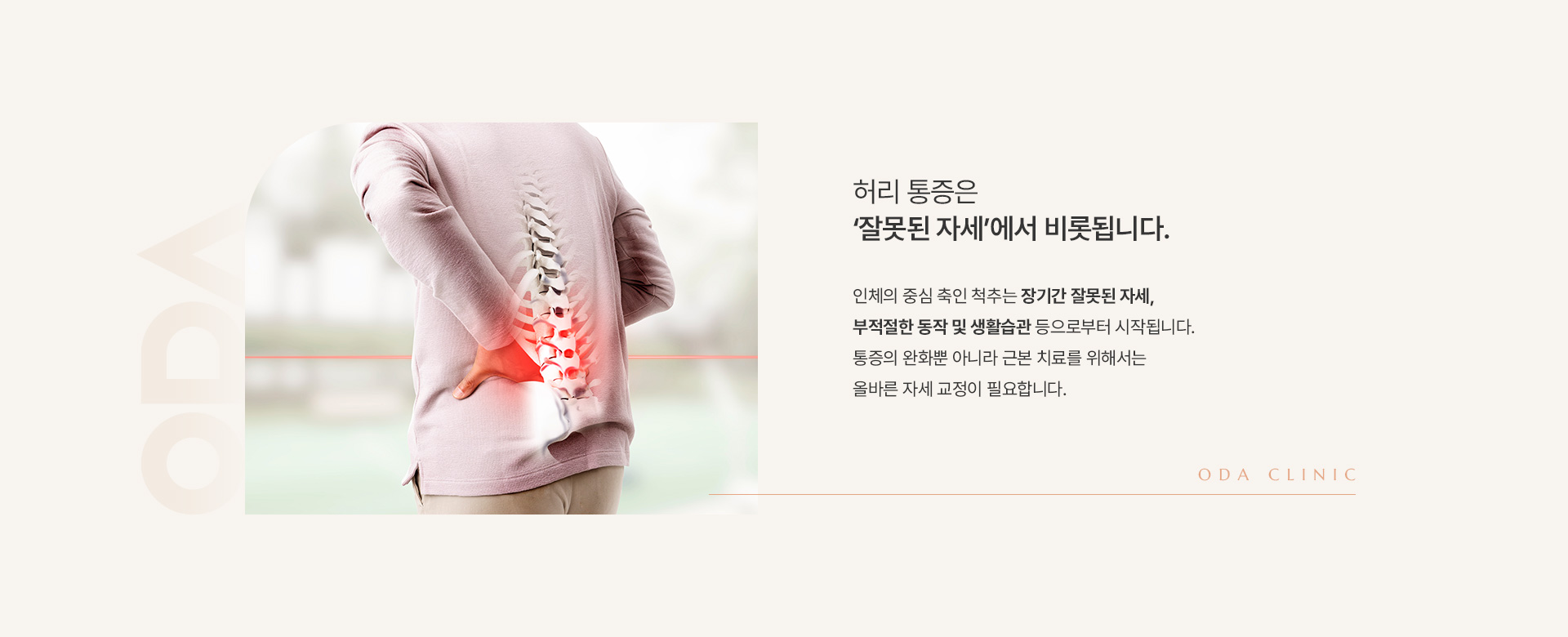 허리통증 상세02